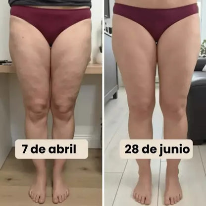 NOÂRA Elevéa — Calza 3D Anticelulitis con Efecto Push-Up